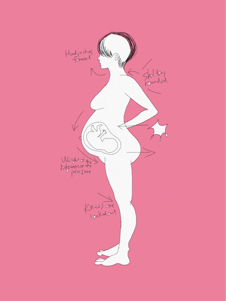 帝王切開後の産婦の足首の痛みと腰痛 ケースレポート カラダスッピン